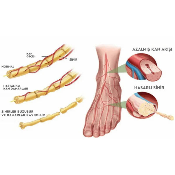 Konforly Ayak Bandı ile Ayak, Ayak Bileği ve Topuk Ağrılarınızı Ortadan Kaldırın