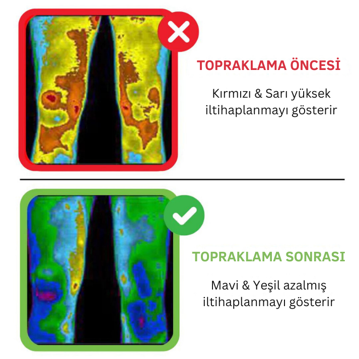 Vücudunuzdaki negatif enerjiyi toprağa aktarın - Konforly™ Topraklama Matı